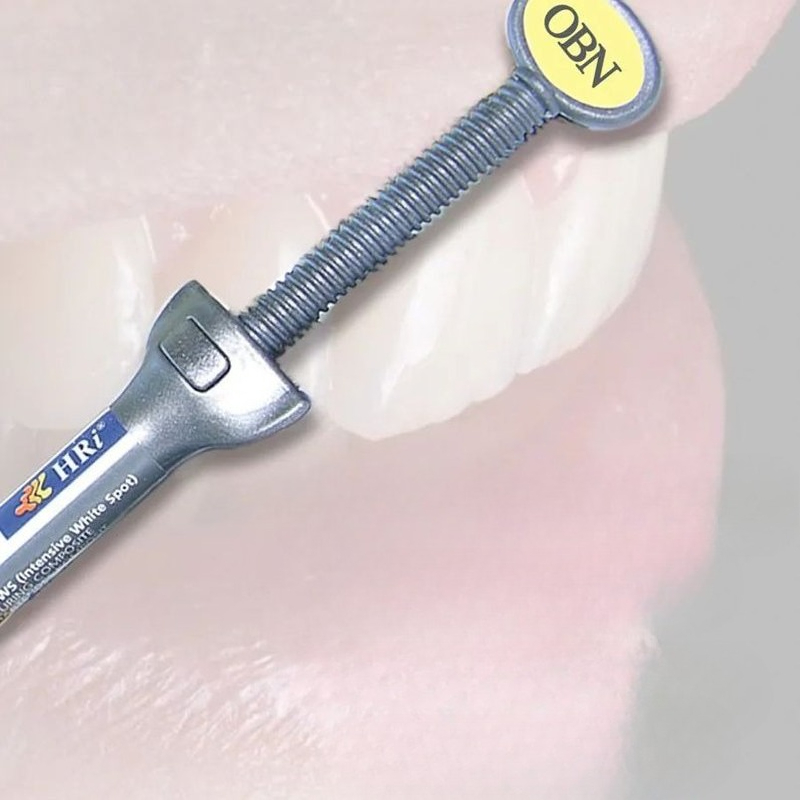 Materiales dentales, resina de - Uv Resin reseña y precio