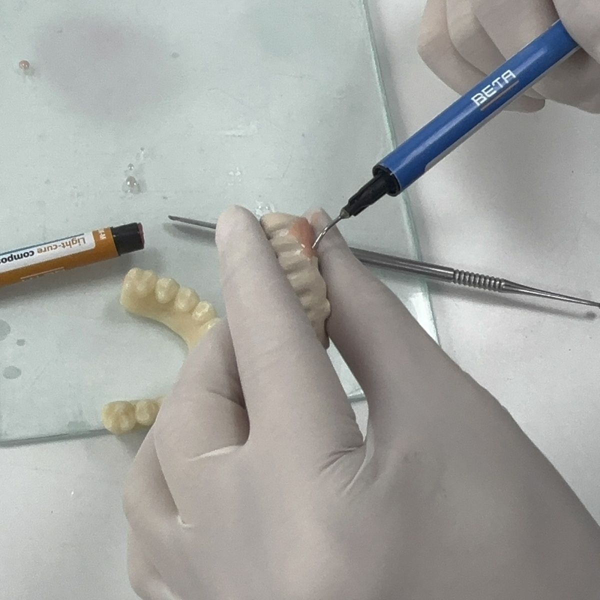Materiales dentales, puente de - Uv Resin reseña y precio