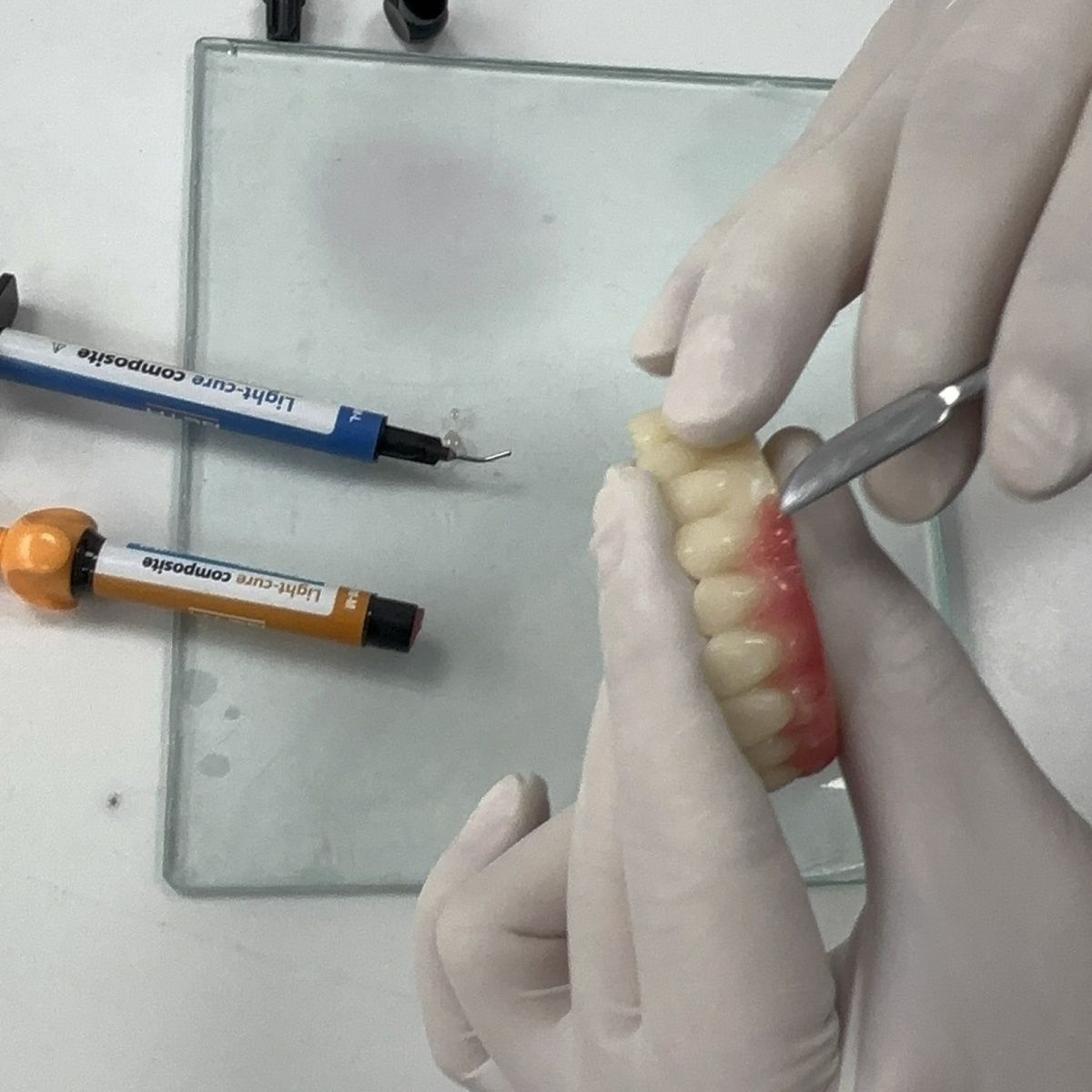 Materiales dentales, puente de - Uv Resin reseña y precio